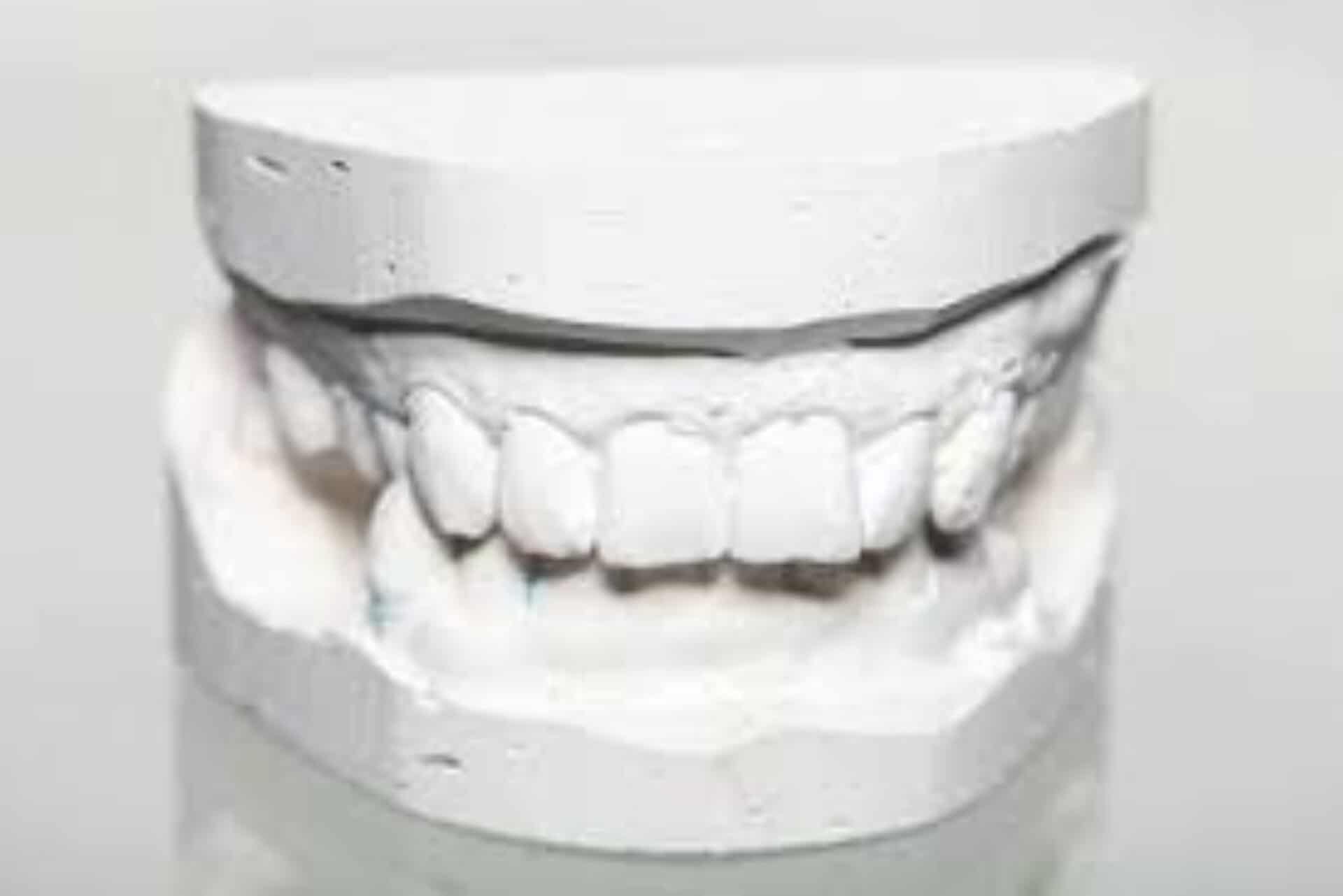 Dentistry gypsum waste management